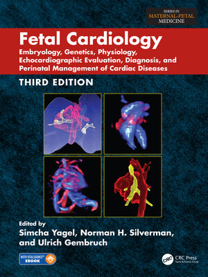 cover image of Fetal Cardiology